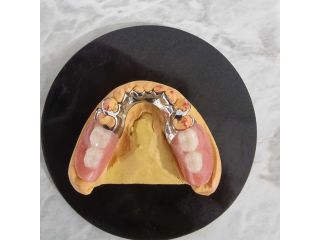 trusted-dental-crown-brisbane-services-book-your-appointment-small-3