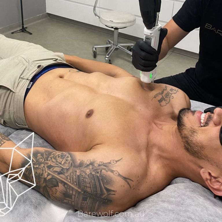 advanced-mens-skin-treatment-sydney-services-big-0