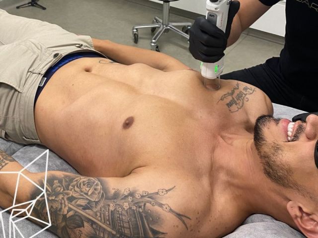 advanced-mens-skin-treatment-sydney-services