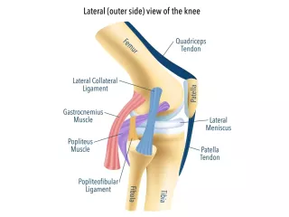 patella-fracture-treatment-that-gets-you-moving-again-small-0