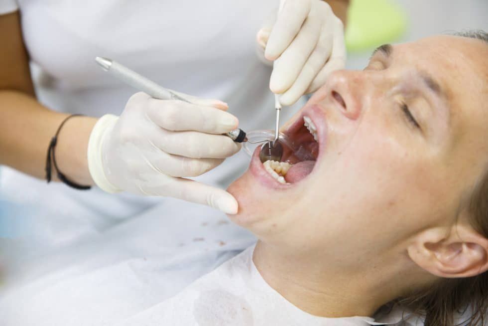 root-canal-treatment-sydney-trusted-root-canal-dentist-big-0