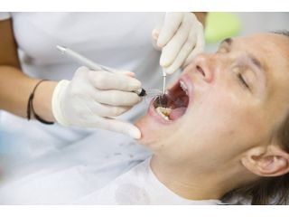 root-canal-treatment-sydney-trusted-root-canal-dentist-small-0