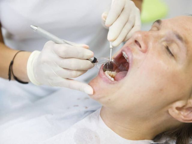 root-canal-treatment-sydney-trusted-root-canal-dentist