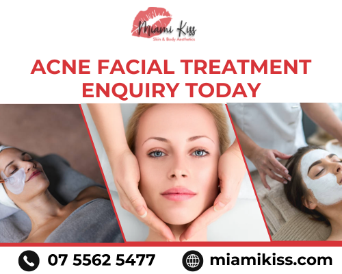 acne-getting-worse-acne-facial-treatment-enquiry-today