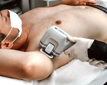 best-laser-hair-removal-clinic-in-moonee-ponds
