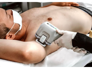 best-laser-hair-removal-clinic-in-moonee-ponds-small-0