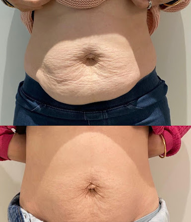 best-body-contouring-clinic-in-berwick-big-0