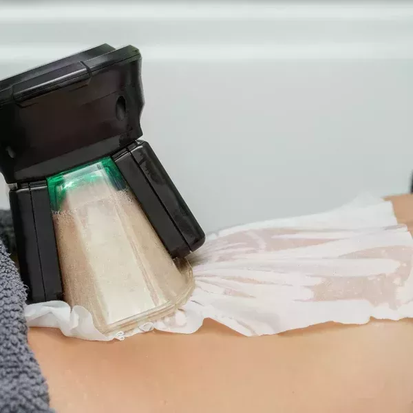 body-fat-freezing-in-varsity-lakes-nearby-suburbs-big-0