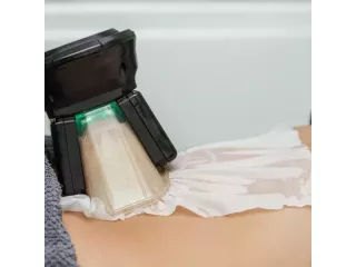 body-fat-freezing-in-varsity-lakes-nearby-suburbs-small-0