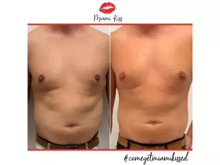 body-fat-freezing-in-varsity-lakes-nearby-suburbs-small-2