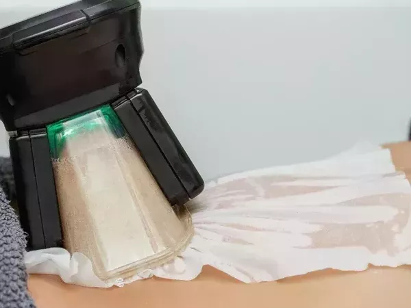 body-fat-freezing-in-varsity-lakes-nearby-suburbs