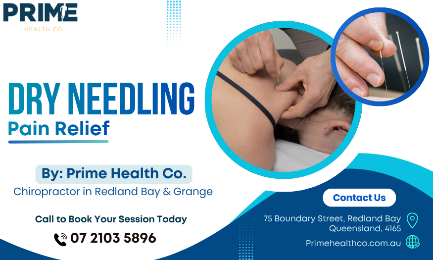 expert-dry-needling-brisbane-services-prime-health-co-big-0