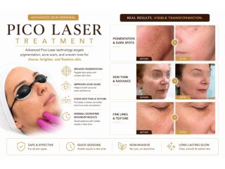 advanced-pico-laser-treatments-for-smooth-radiant-skin-small-0