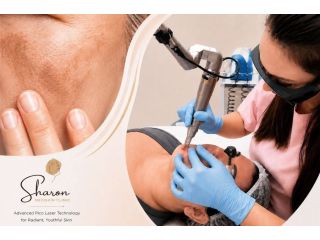 pico-laser-for-melasma-asian-skin-treatment-in-sydney-small-0