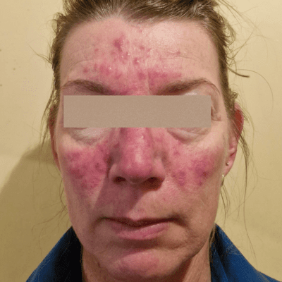 top-skin-laser-clinic-solutions-amora-skin-beauty-big-0