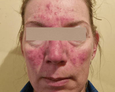 top-skin-laser-clinic-solutions-amora-skin-beauty