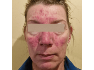 top-skin-laser-clinic-solutions-amora-skin-beauty-small-0