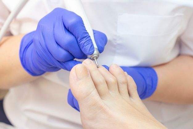 affordable-podiatrist-in-cheltenham-for-foot-care-solutions-big-0