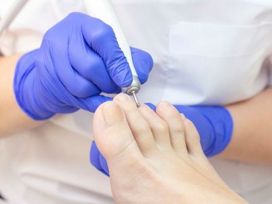 affordable-podiatrist-in-cheltenham-for-foot-care-solutions