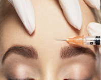 best-botox-in-chelsea