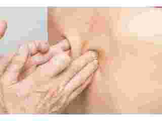 personalized-remedial-massage-adelaide-for-optimal-health-small-0