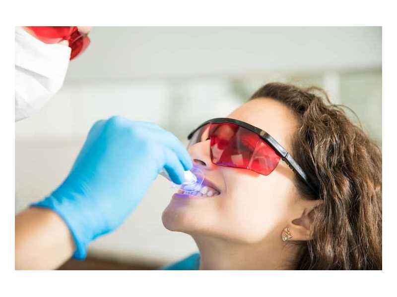 access-to-professional-teeth-whitening-services-in-caulfield-small-0