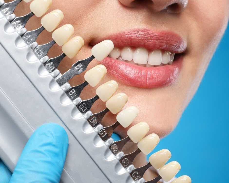 trusted-dentist-lysterfield-delivering-quality-care-at-the-smile-clinic