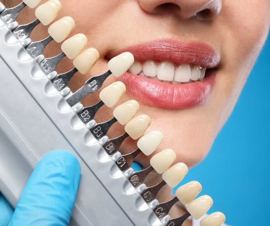 trusted-dentist-lysterfield-delivering-quality-care-at-the-smile-clinic-big-0