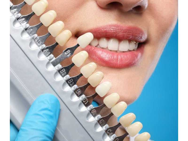 trusted-dentist-lysterfield-delivering-quality-care-at-the-smile-clinic-small-0
