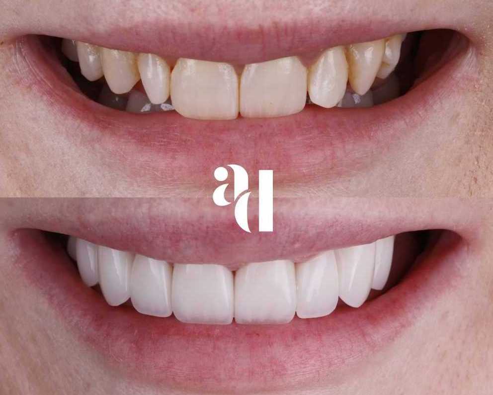 cosmetic-dentist-penrith-avira-dental