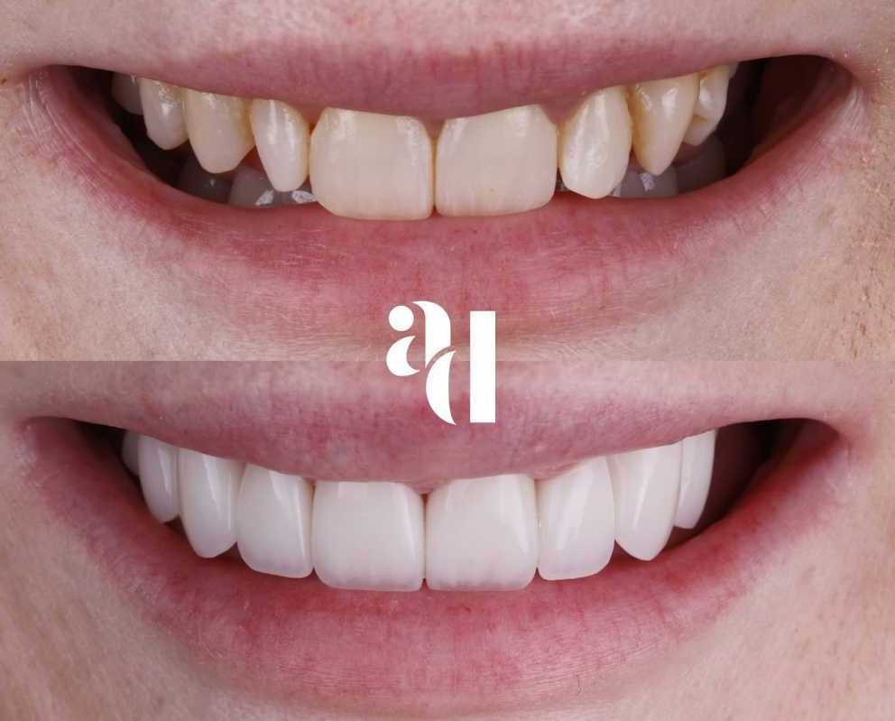 cosmetic-dentist-penrith-avira-dental-big-0