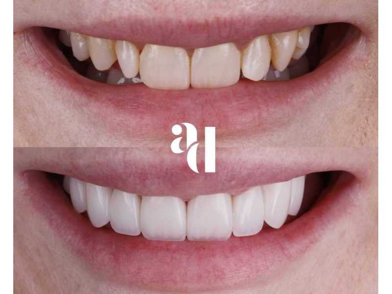 cosmetic-dentist-penrith-avira-dental-small-0