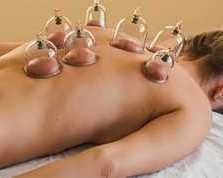 best-service-for-cupping-in-essendon-west