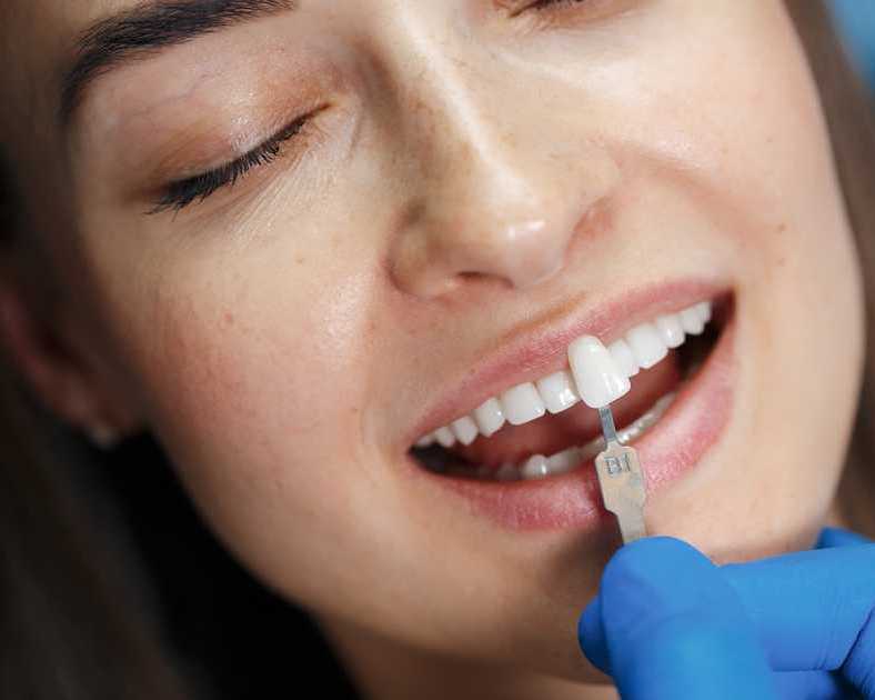 custom-veneers-in-port-kennedy-qvc-dental
