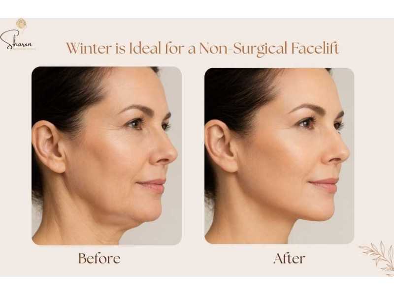why-winter-is-ideal-for-a-non-surgical-facelift-in-sydney-small-0