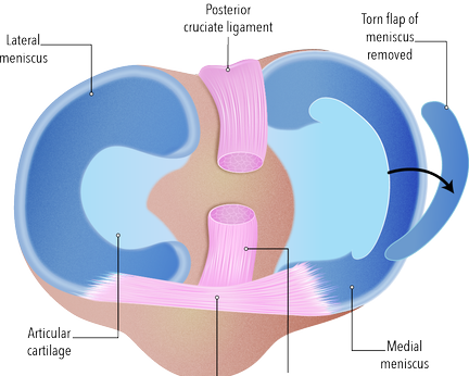 find-practical-options-for-osteoarthritis-treatment