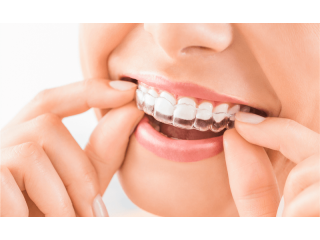 Expert Merrylands Dental Care - Krown Dental: Where Smiles Shine Bright!
