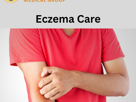 eczema-care-expert-tips-relief-big-0