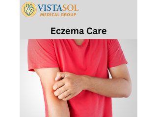 eczema-care-expert-tips-relief-small-0