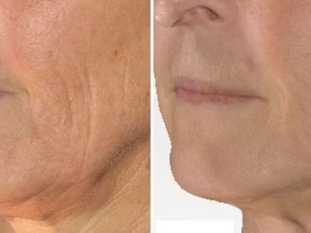 best-nail-fungus-treatment-services