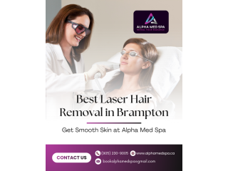 best-laser-hair-removal-in-brampton-alpha-med-spa-small-0