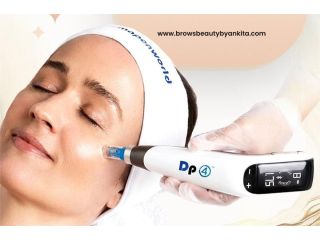 refresh-your-look-injectable-treatments-ontario-small-0