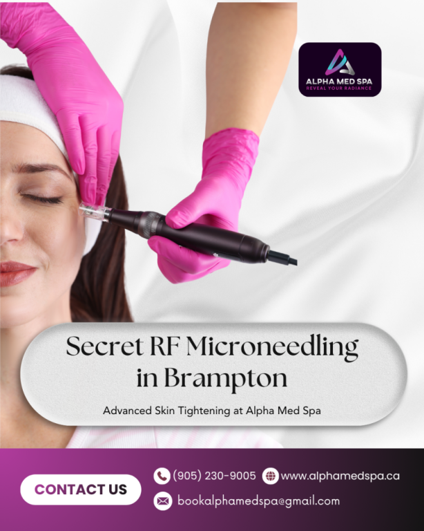 secret-rf-microneedling-in-brampton-big-0