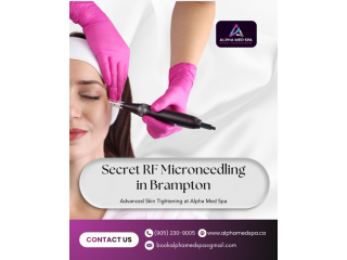 secret-rf-microneedling-in-brampton-small-0