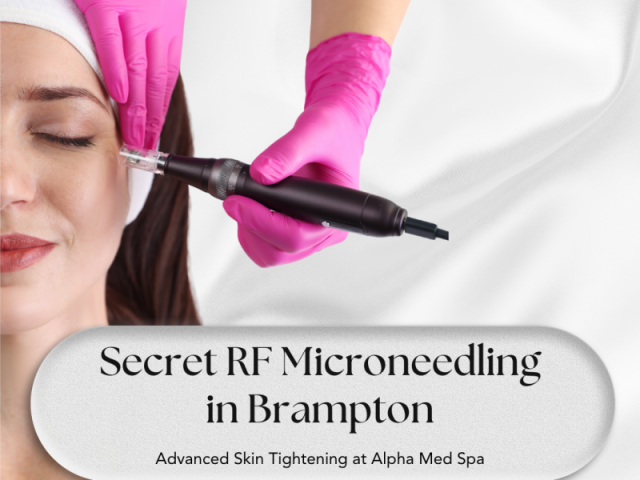 secret-rf-microneedling-in-brampton