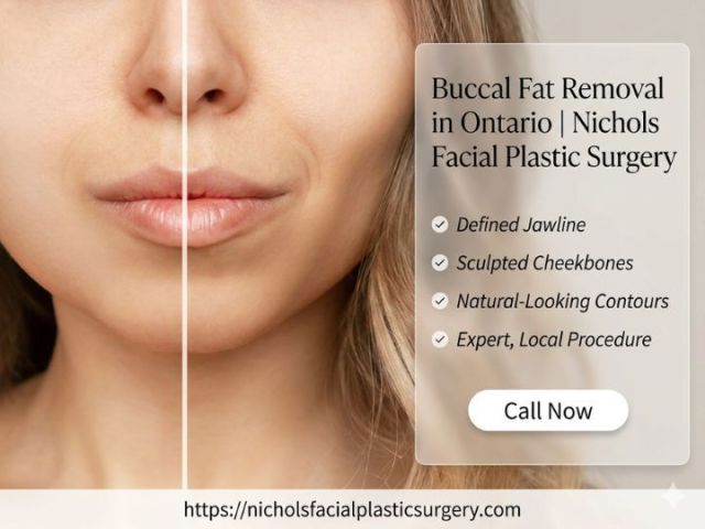 buccal-fat-removal-in-ontario-nichols-facial-plastic-surgery