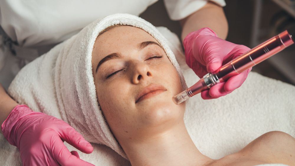 microneedling-surrey-for-acne-scars-fine-lines-book-today-big-0