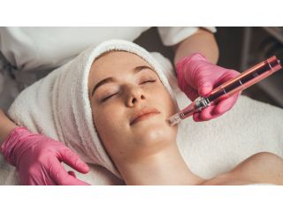 microneedling-surrey-for-acne-scars-fine-lines-book-today-small-0