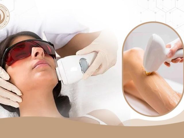 smooth-skin-laser-treatment-aafiyat-aesthetic
