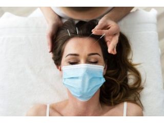 holistic-healing-through-acupuncture-care-small-0
